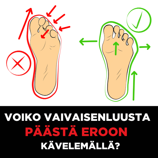 Vaivaisenluu hoito - eroon kävelemällä
