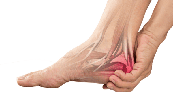 Plantaarifaskiitti - oireet, syyt ja hoito